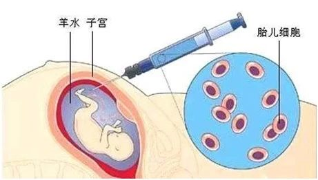 無創胎兒親子鑒定、羊水親子鑒定、毛發親子鑒定分別怎么做？