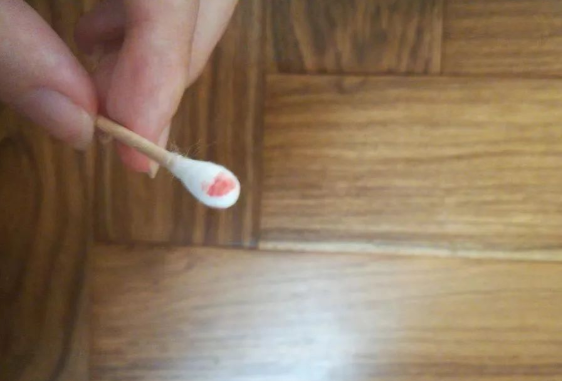 煙頭、血痕、毛發(fā)，做親子鑒定用哪些樣本最為準確？