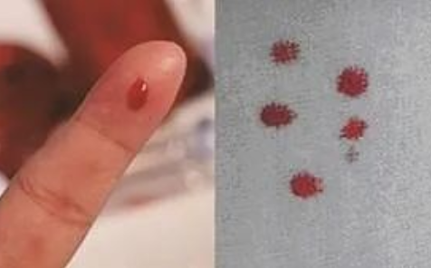 匿名親子鑒定需要準(zhǔn)備什么？親子鑒定工作人員采樣本流程有哪些？