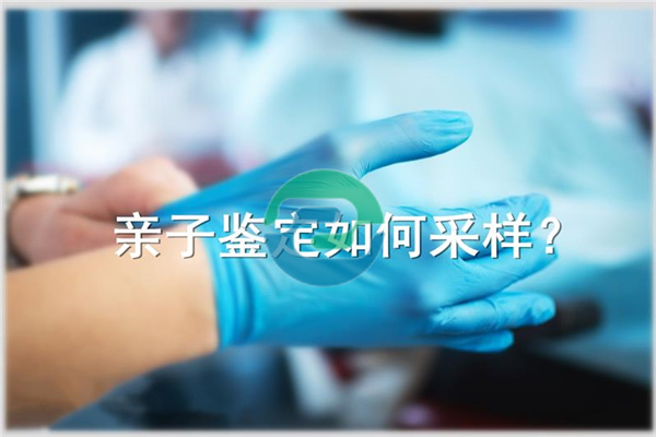 中山親子鑒定需要注意哪些事項？